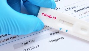 كشف علامات مشتركة بين فيروس كورونا