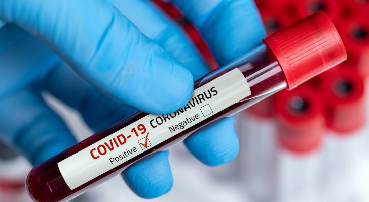 فحص الدم وعدوى كورونا.. دراسة تكشف