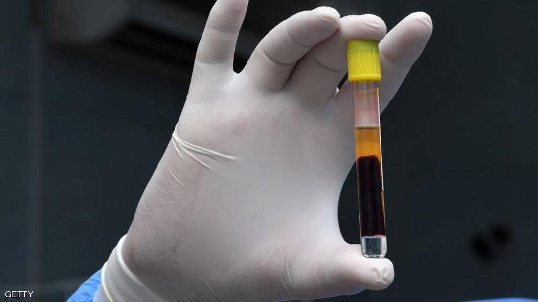 دراسة سويدية تكشف «مفاجأة جديدة» بشأن