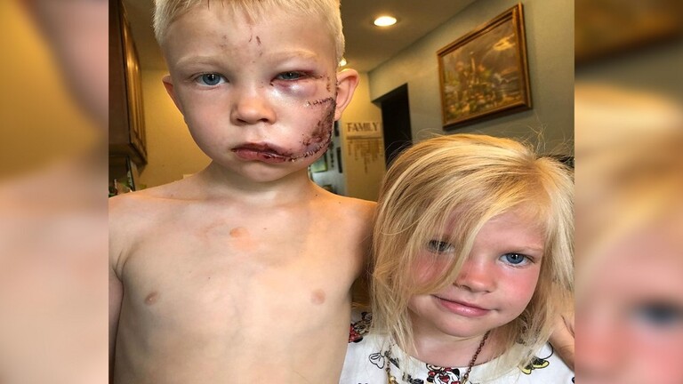 طفل يتصدى لكلب شرس دفاعا عن