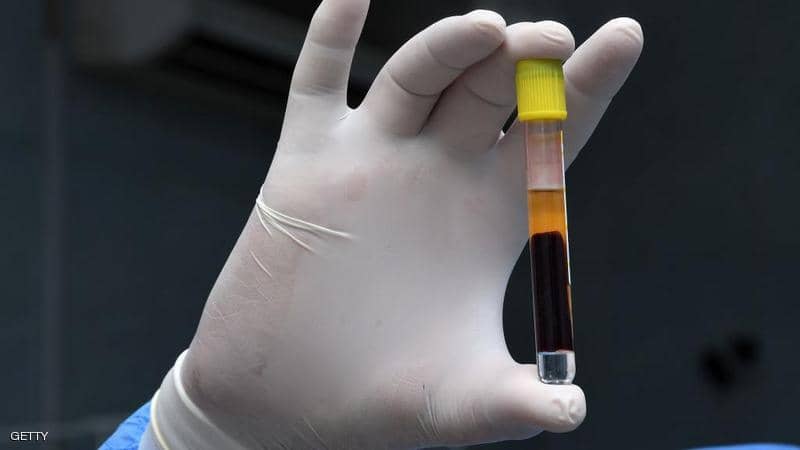 فيروس كورونا وفصيلة الدم.. دراسة تحسم