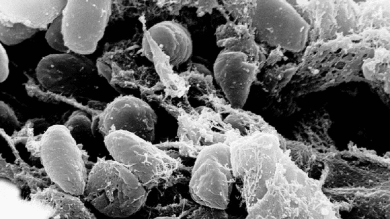 الطاعون الدبلي يطرق باب أميركا