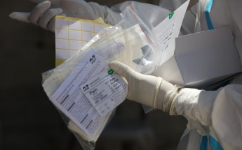 تسجيل 244 إصابة جديدة بفيروس كورونا