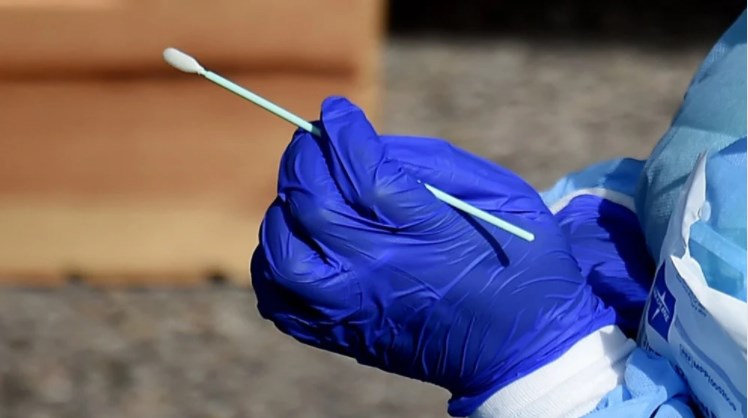 الصحة: الأردن يجري أضعاف الفحوصات التي