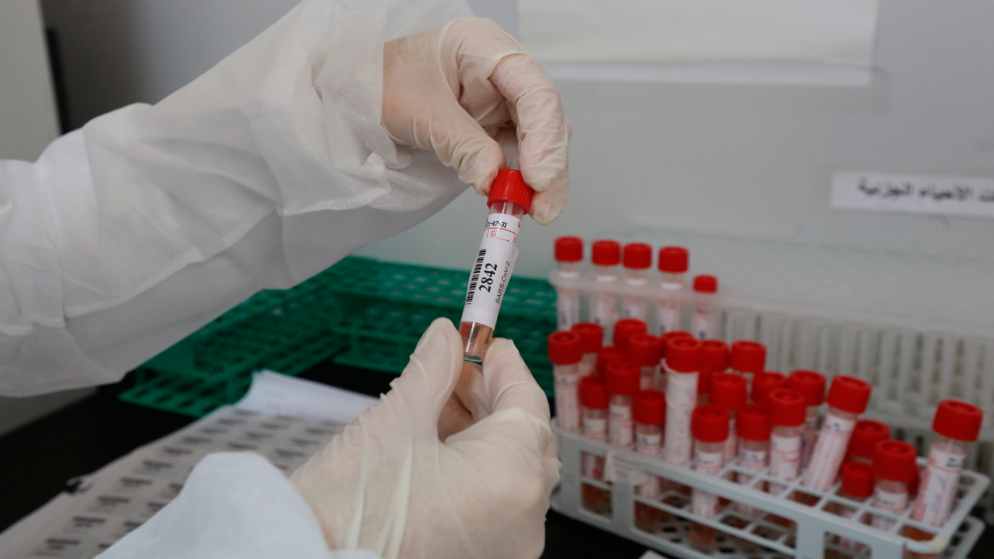 وفاتان و724 إصابة جديدة بالفيروس في