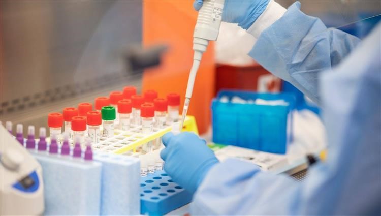 تسجيل إصابة جديدة بفيروس كورونا في