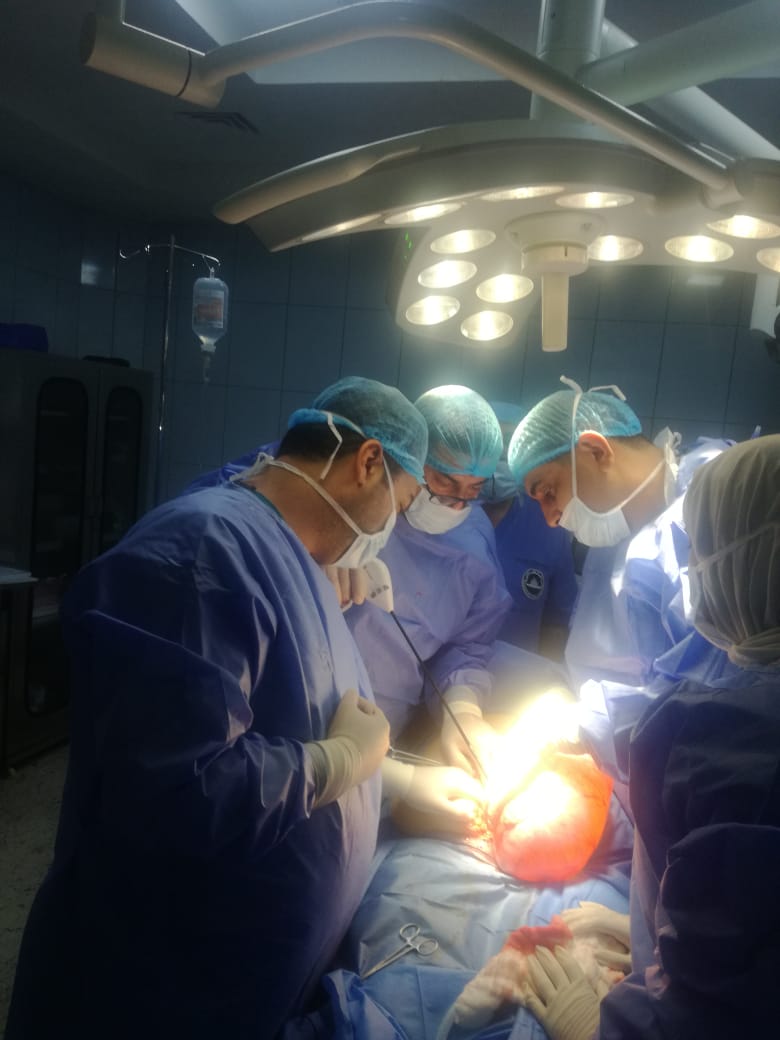استئصال ورم ضخم من بطن سيدة