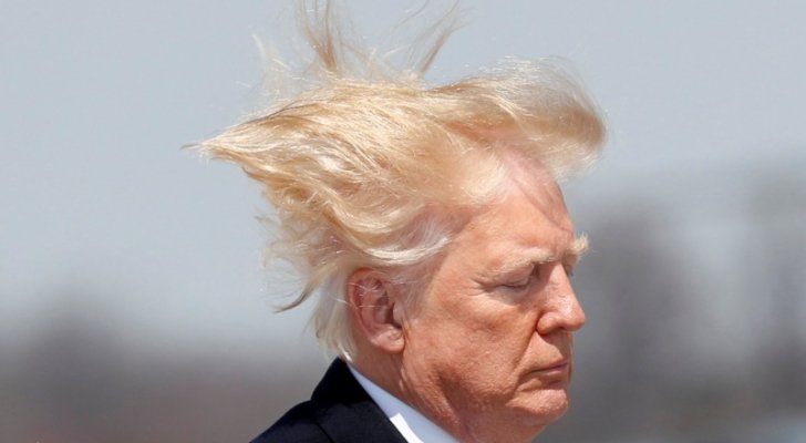 طبيب ترمب: الرئيس لا يعاني من