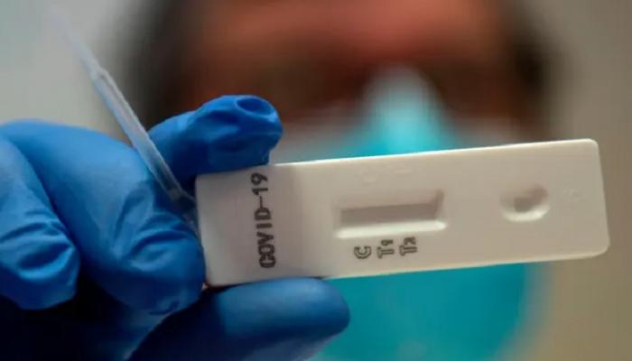 الصحة: كتات فحص كورونا في الأردن