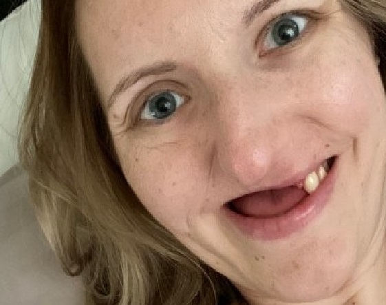 تعاني من ألم في أسنانها.. فتكتشف