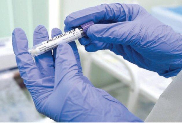 تطوير اختبار يتيح اكتشاف كورونا خلال