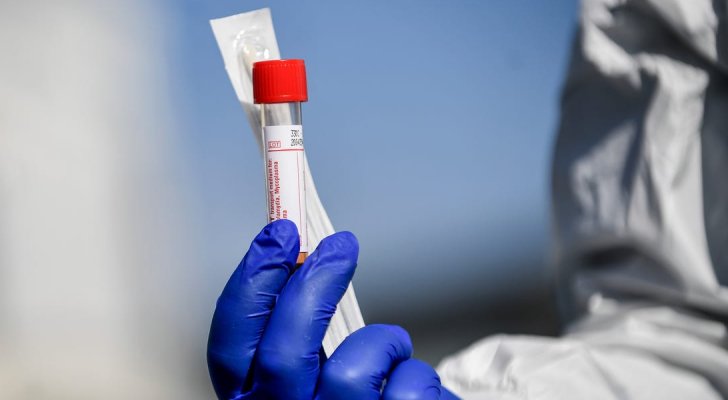 العقبة.. مختبر جديد لإجراء فحوصات كورونا