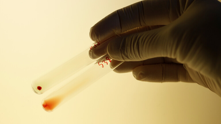 دراستان تكشفان عن فصيلة دم الأشخاص