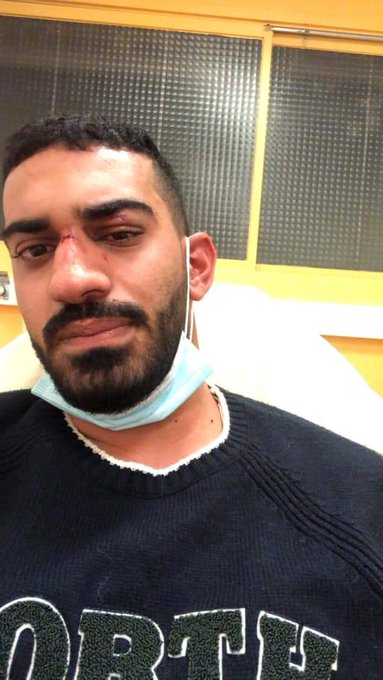 تعرض شاب أردني وشقيقته الى اعتداء