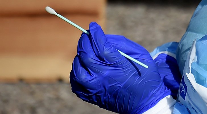 خبراء يشككون في فحوص كورونا: ليست