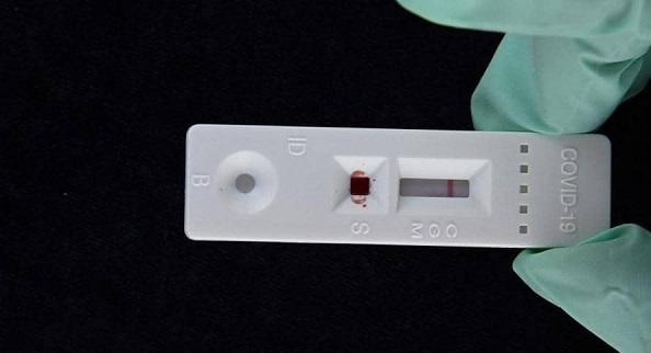 لماذا يجب ألا نقلق من تراجع