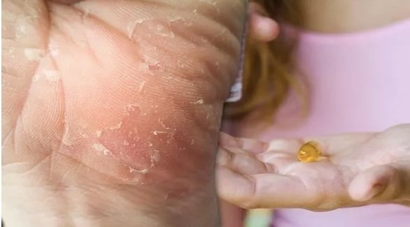 إليك سيدتي أفضل المكملات الغذائية للوقاية