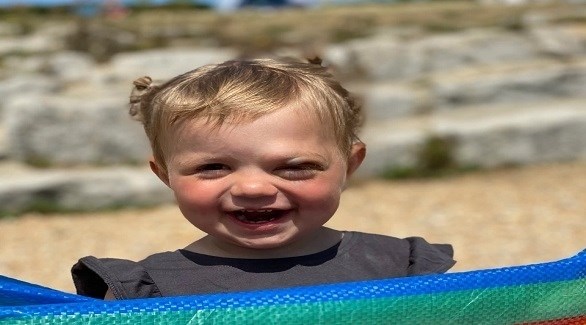 طفلة تذرف الدم بدل الدموع بسبب