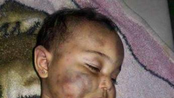 صور مروعة .. أب سوري يقتل