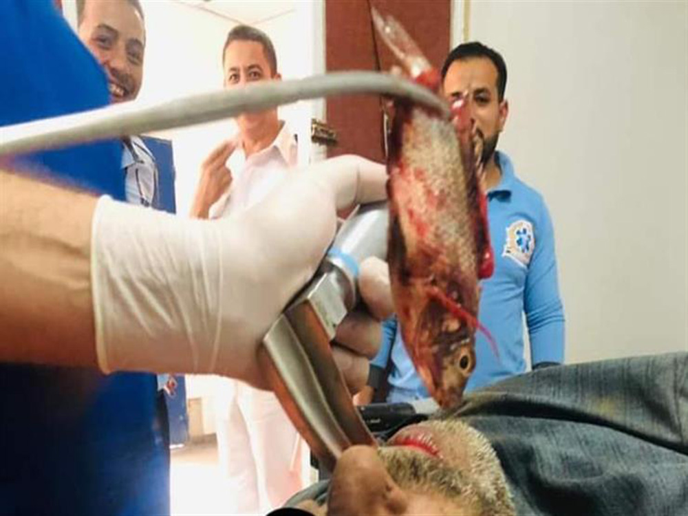 إخراج سمكة حية من جوف صياد