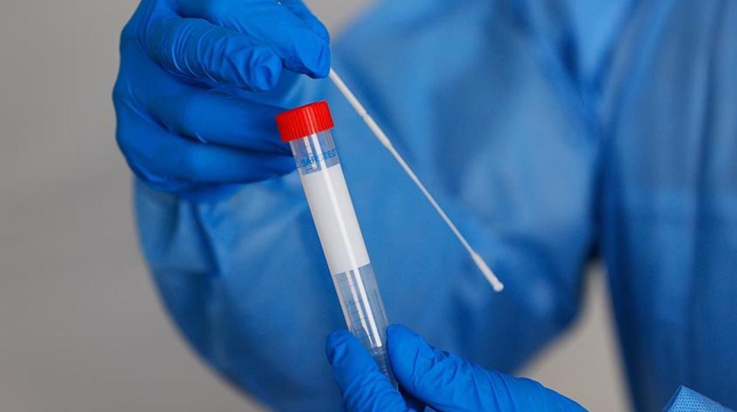 الحجاوي: إصابات «مخالطة الانتخابات» ستظهر بدءا