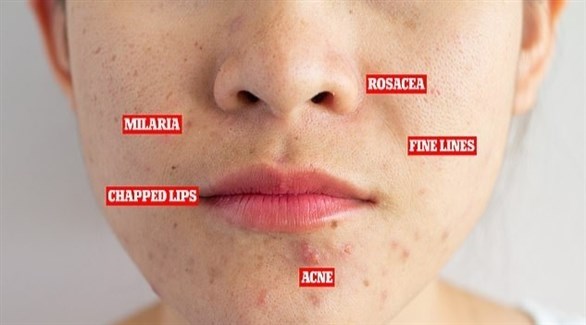 خبير يكشف التأثيرات السلبية للكمامة على