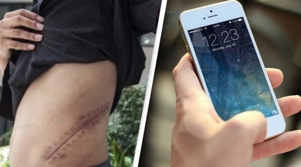 مراهق باع كليته لشراء آي فون..