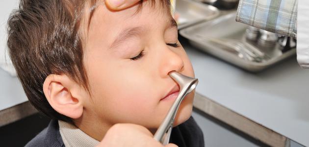 دراسة: الأشخاص المصابون باحتقان الأنف أكثر