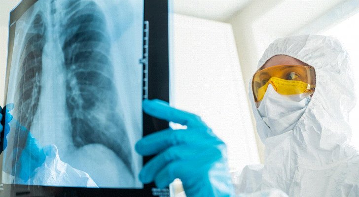 دراسة ترصد ضررا في الرئة يطول