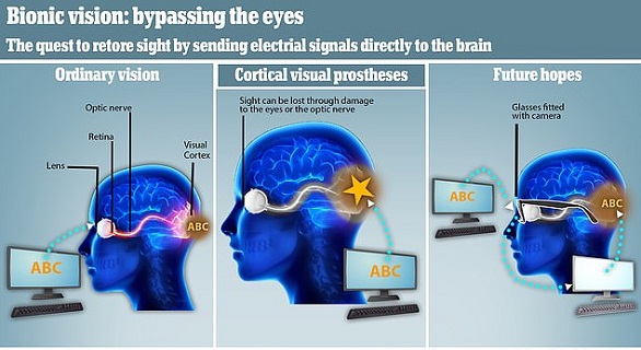 زرعات دماغية يكن أن تعيد الرؤية