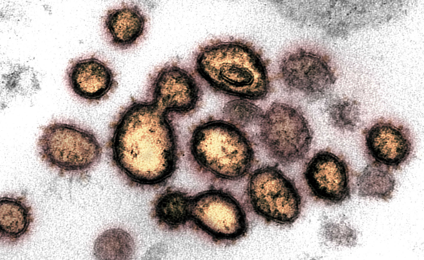 اكتشاف يفتح الباب أمام طرق علاج