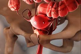 هذا المرض قد يحرمك من الأمومة