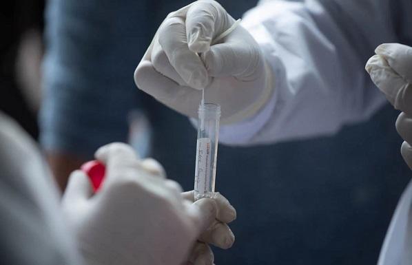 مختبر لفحص كورونا بالبادية الشمالية