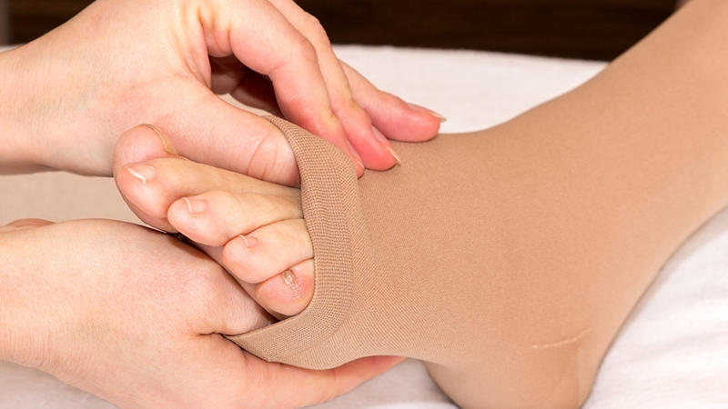 ما هو القصور الوريدي المزمن؟