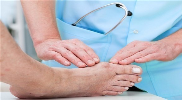 عوامل تزيد خطر الإصابة بالنقرس