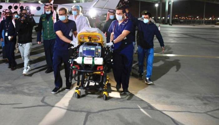 التوأم الطفيلي اليمني يصل إلى السعودية