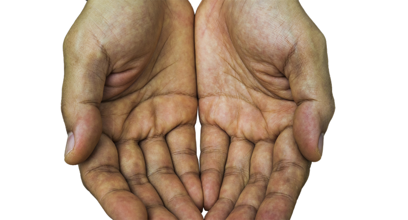 علامة في كف اليد قد تشير