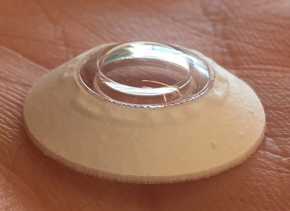 يستعيد بصره بعد 10 أعوام بأول