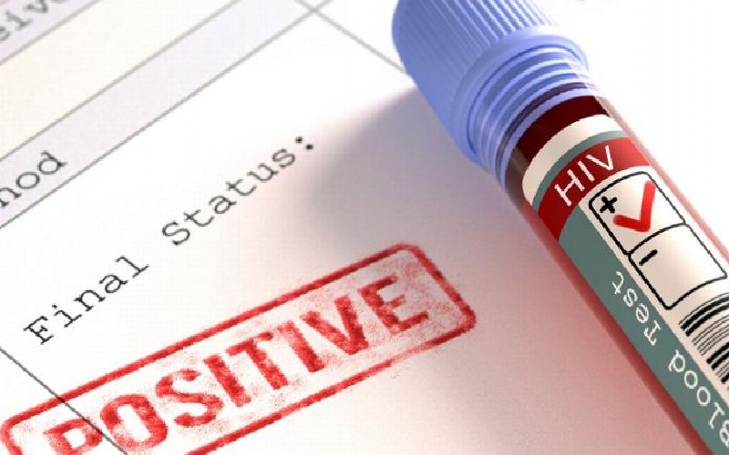 أول إصابة بـنقص المناعة البشرية.. متى