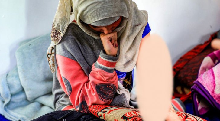 يمني يسكب ماء الأسيد على وجه