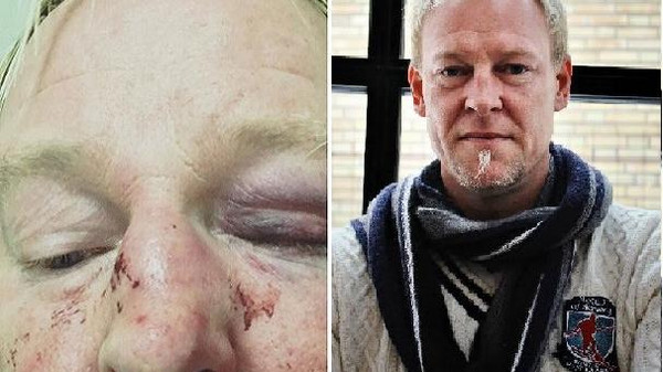 مسلمون انهالوا ضربا على سويدي شهير