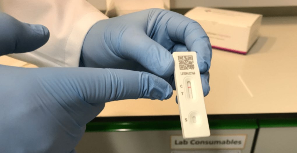 فحص كورونا السريع.. كم يستغرق من