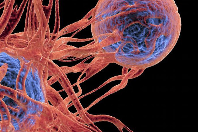 تتغلب على السرطان بعد أن كانت