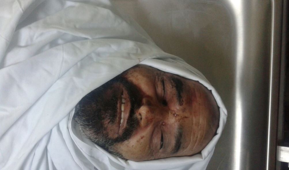 صور للشهيد الكسجي من مستشفى البشير..