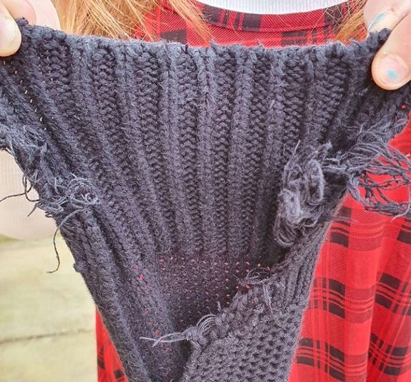 تعاني من حالة نادرة تجعلها تأكل