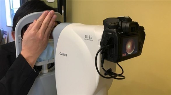 فحص متطور للعين يكشف عن الطفل