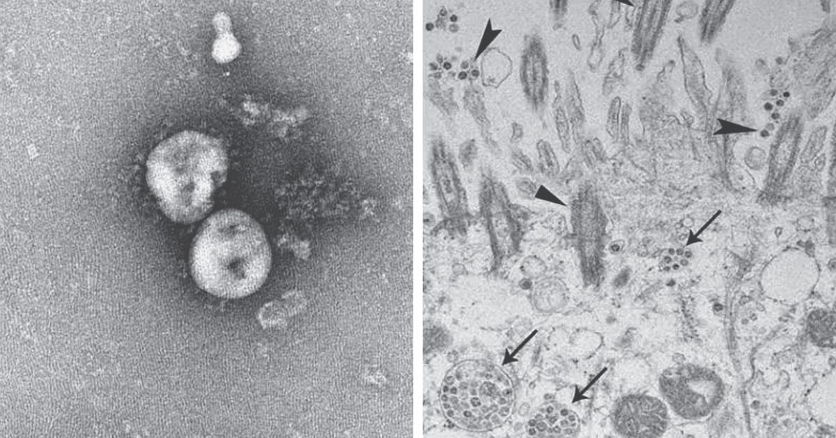 ما زالت مجهولة الفعالية.. اكتشاف طفرة