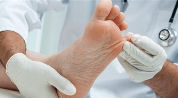 مع اقتراب الصيف.. . نصائح للوقاية