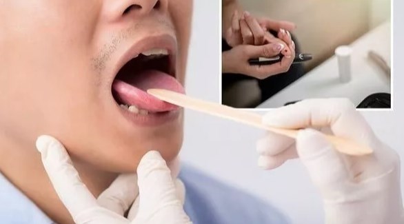 أعراض على اللسان تنبئ بداء السكري