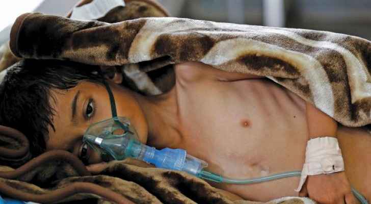 ’الكوليرا‘ يحصد أرواح 1636 1639 1635